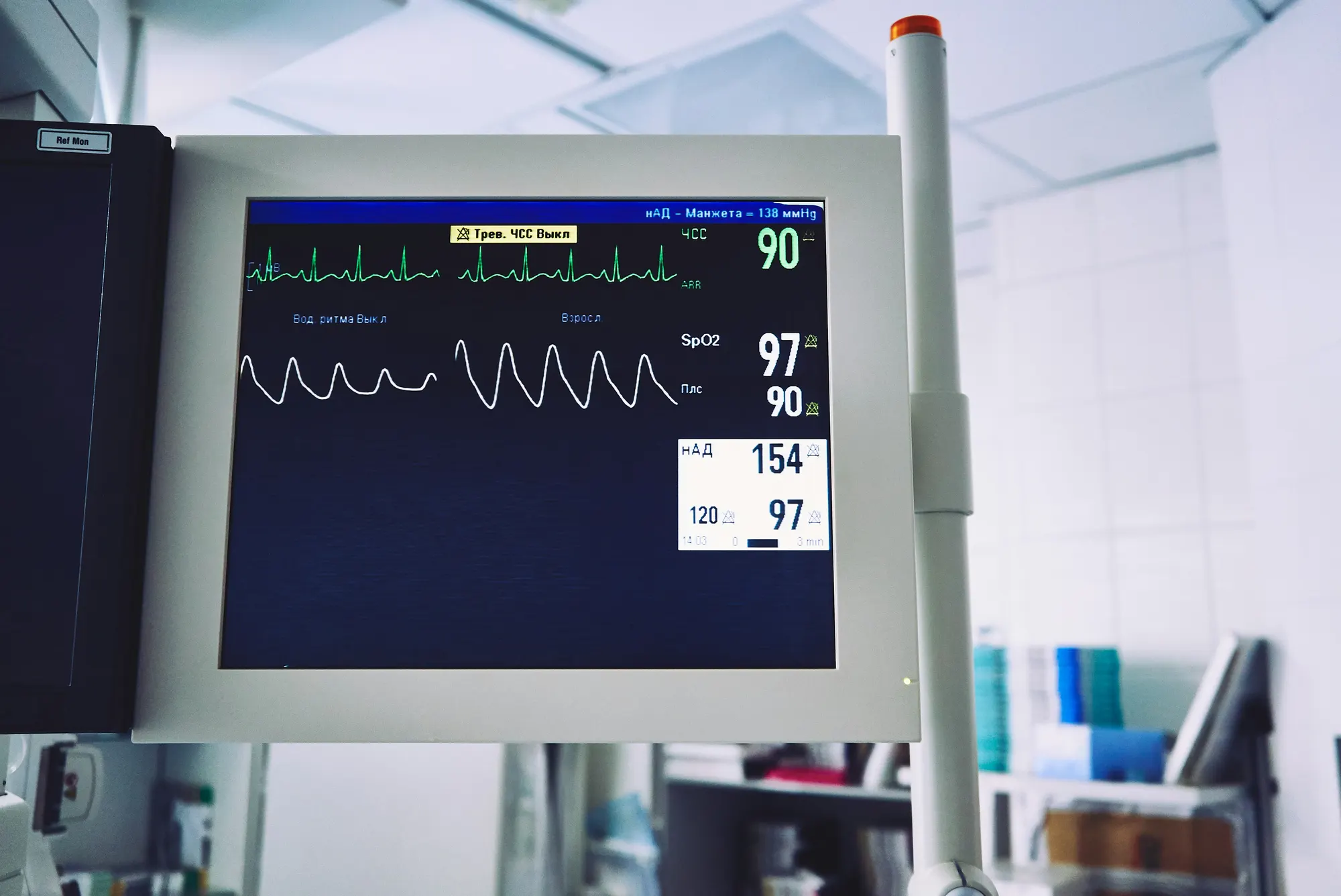 A patient monitor tracking heart rhythm, oxygen, and blood pressure
