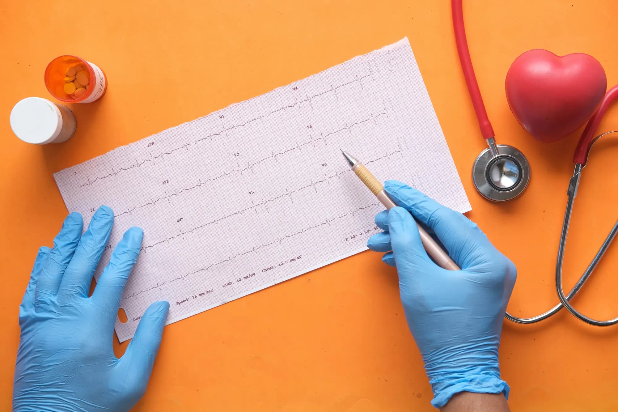 Gloved hands marking up an ECG strip beside a stethoscope and a model heart